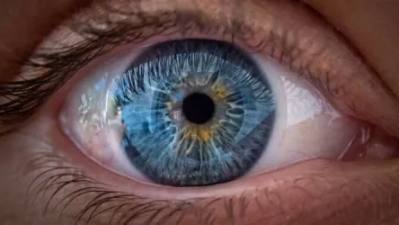 eye