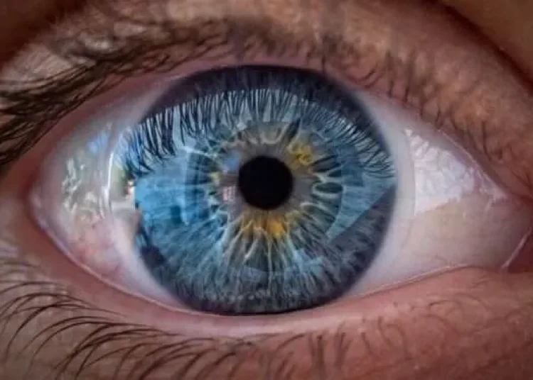 eye