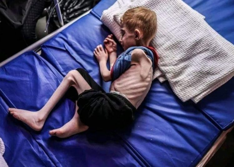 gaza starvation