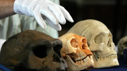 human skull