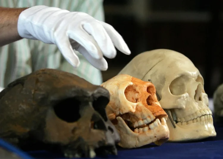 human skull