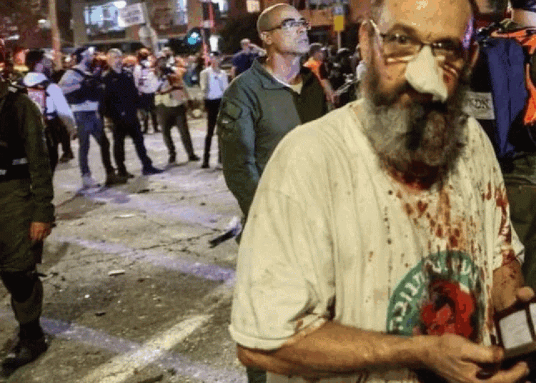 iran attack israel